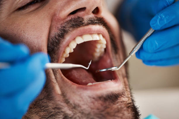 Best Pediatric Emergency Dentist in Chaffee, MO