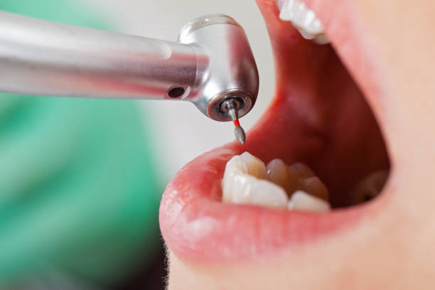 Best Emergency Treatment for Dental Infections or Abscesses in Chaffee, MO